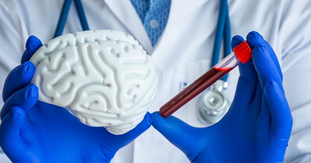 How Close are We to a Blood Test for Alzheimer’s? about false