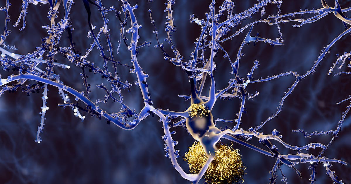 New Algorithm Might Predict Alzheimer's about undefined