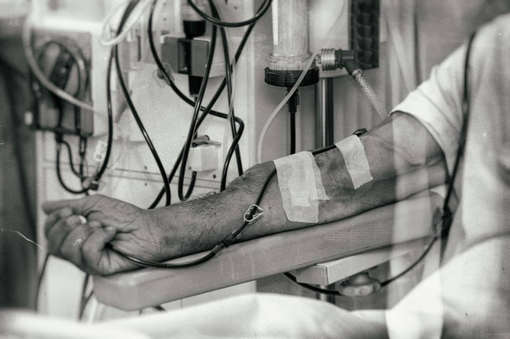 This Medical Procedure Contributes to Dementia about false