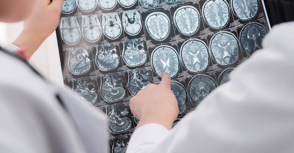 This Simple Device Could Soon Be Used to Treat Alzheimer's about false