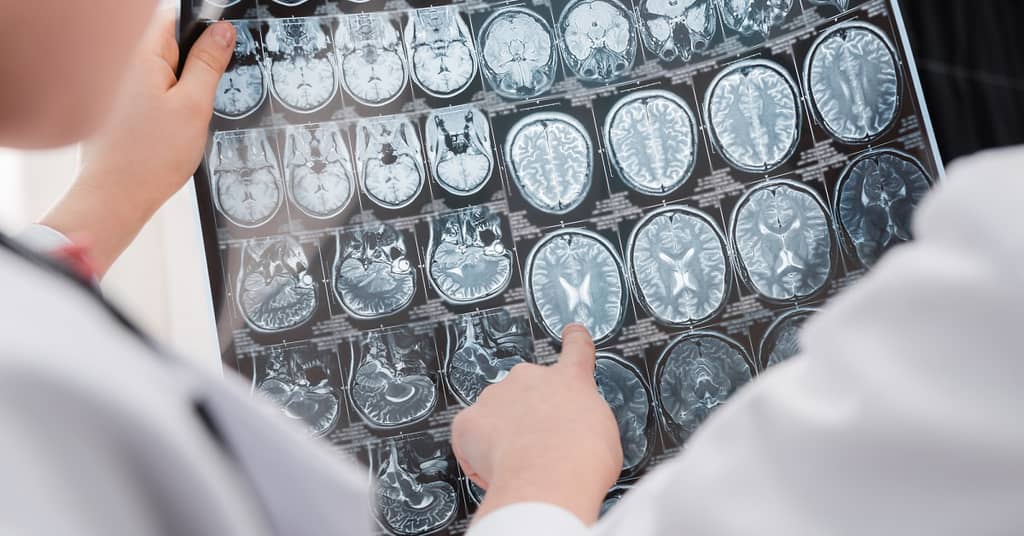 High-Tech Headband Provides an Early Warning of Dementia about false