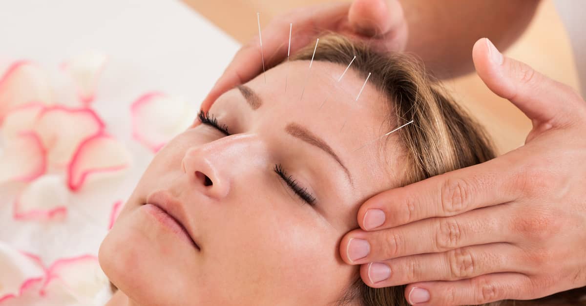 How Acupuncture Can Reshape Your Brain about undefined