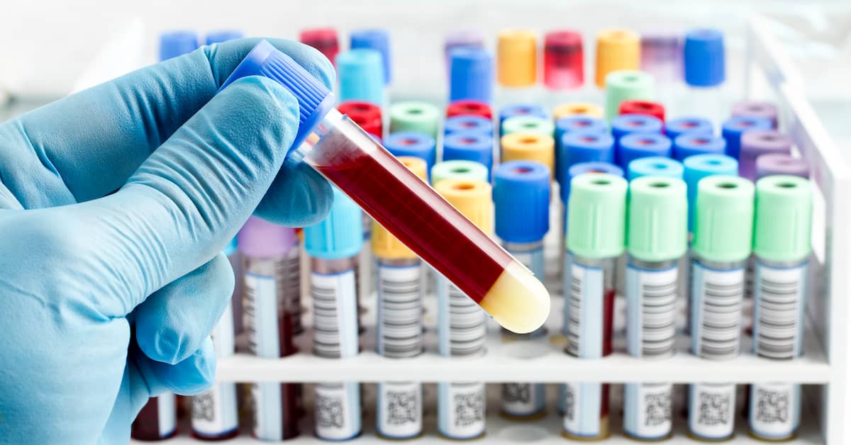 Blood Test Reveals Whether You Have Any Kind of Brain Disorder about undefined