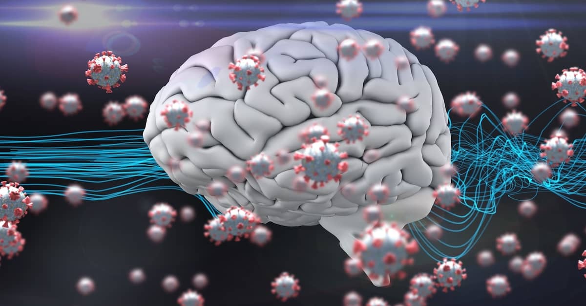 Does COVID Trigger Alzheimer's Disease? about undefined