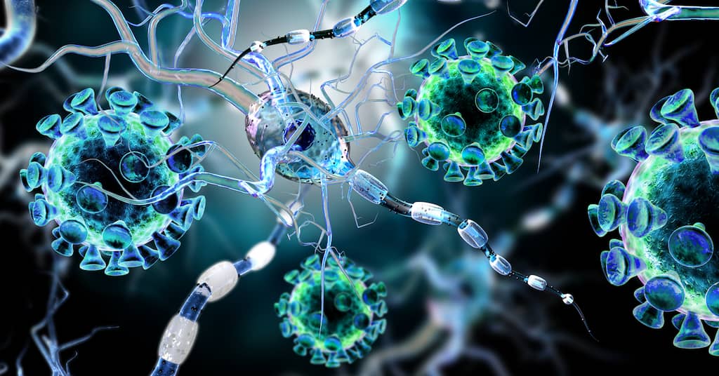 What If Alzheimer’s Isn’t A Brain Disease? A Canadian Scientist’s New Discovery… about false