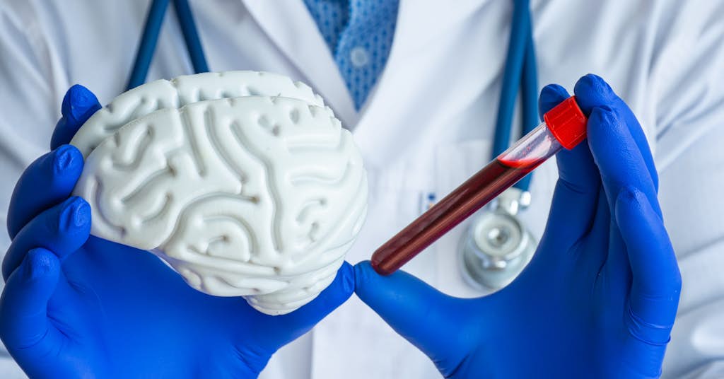 New Biomarker Identifies Alzheimer’s At An Early Stage about false
