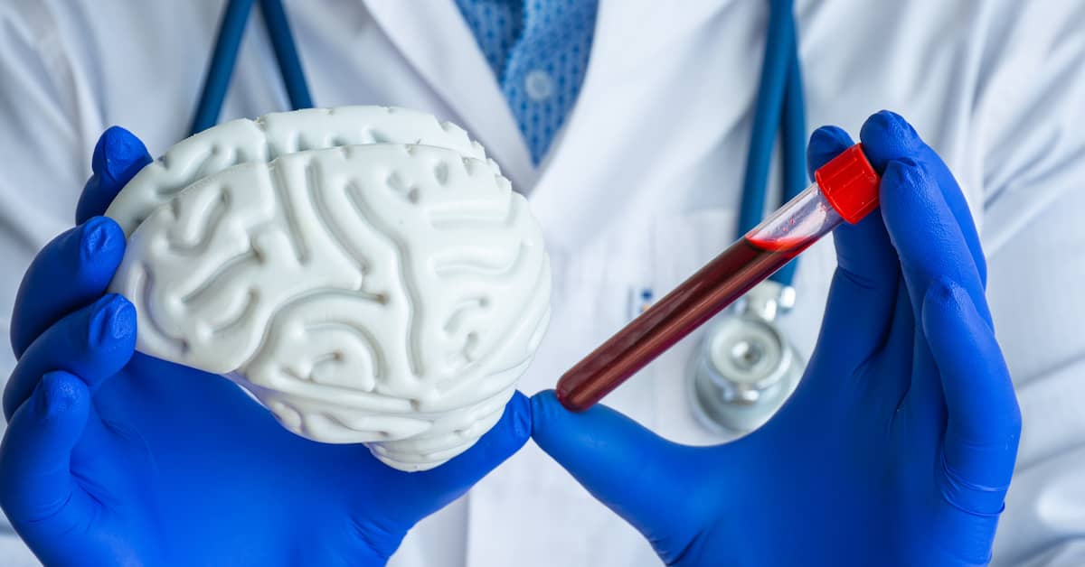 New Biomarker Identifies Alzheimer’s At An Early Stage about undefined